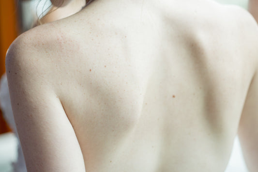 Photo of a woman taken from behind showing her bare back